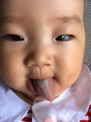 一个月的宝宝拉肚子