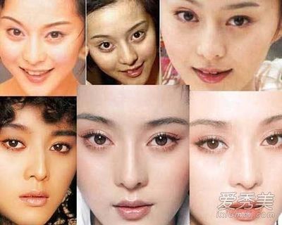 女明星的双眼皮