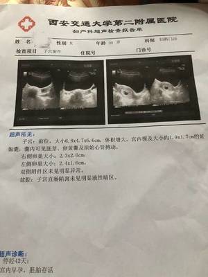 怀孕检查什么项目