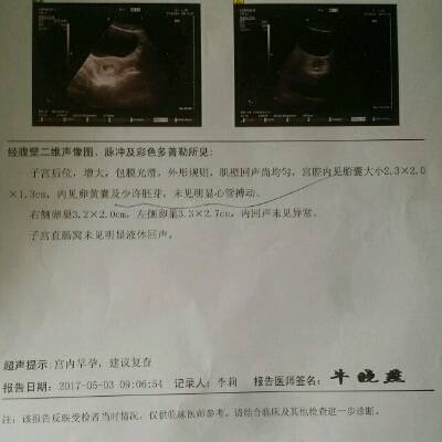 多囊怀孕