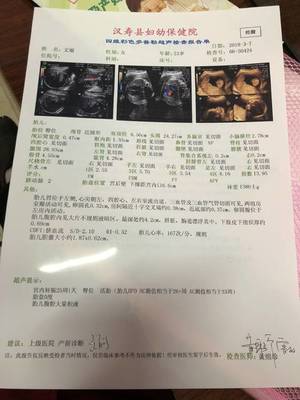 怀孕25周胎儿有多大