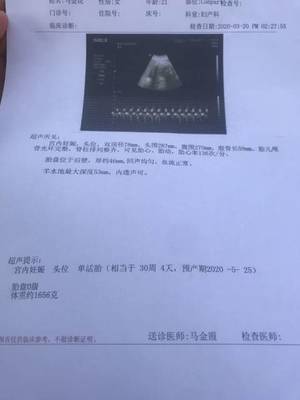 胎儿发育小