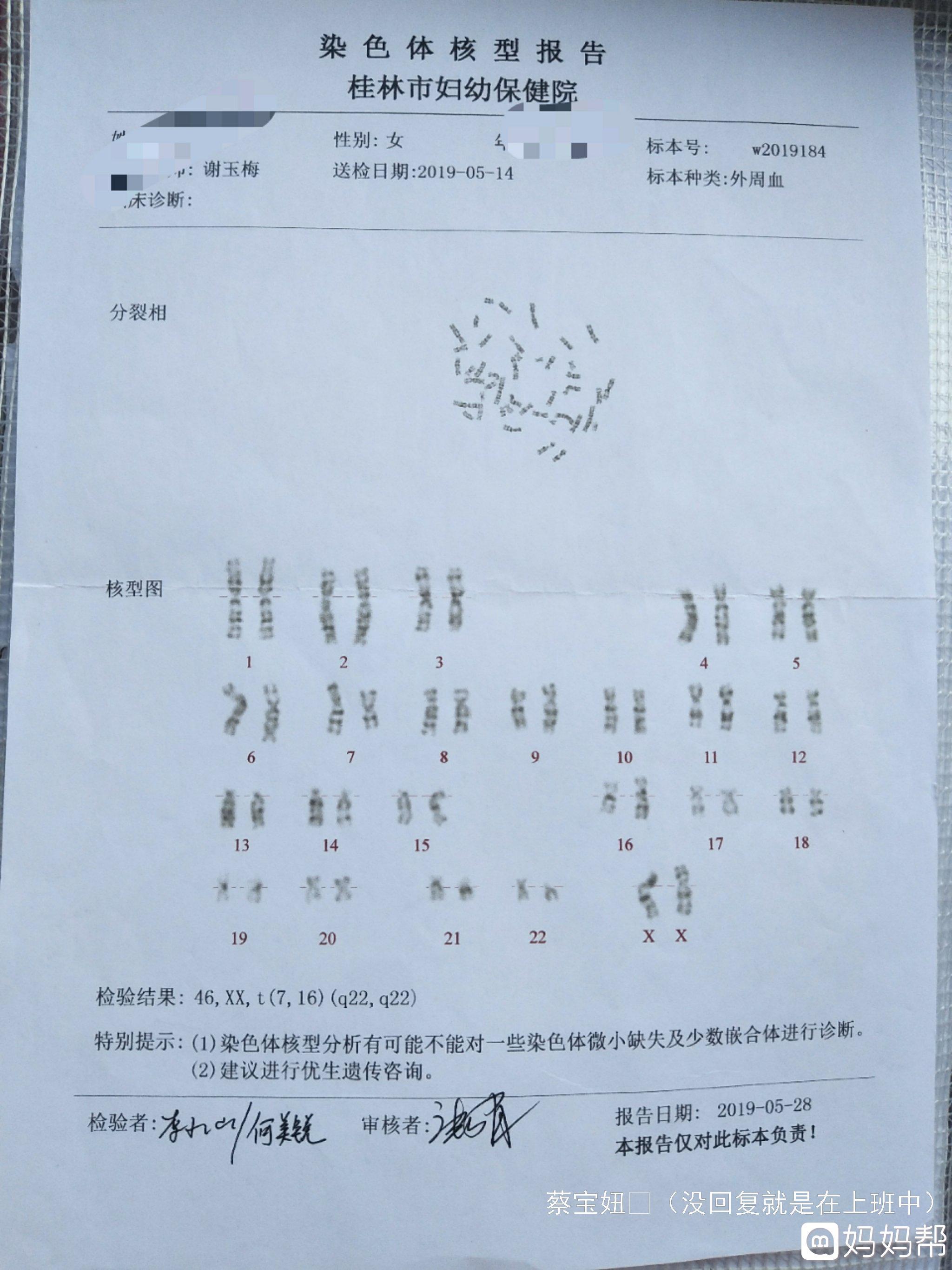 染色体平衡易位孕9个月