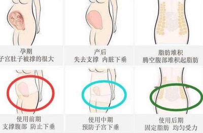 生完宝宝多久可以用收腹带