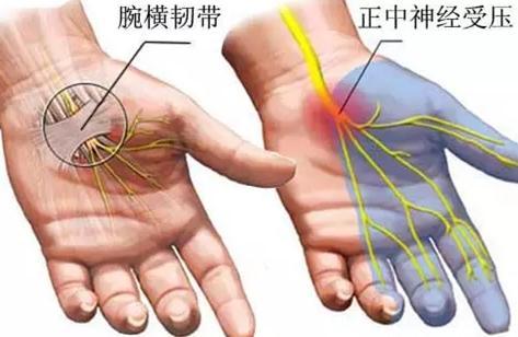 手麻痛是怎么回事