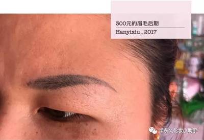 半永久眉毛失败案例