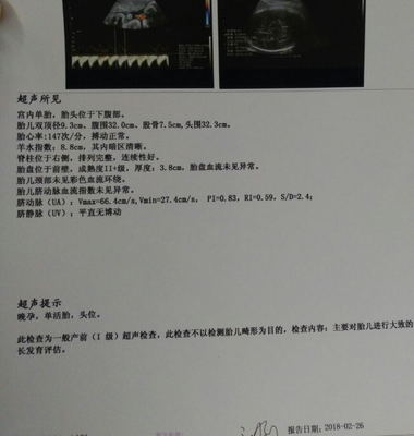 足月胎儿股骨长标准