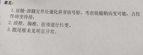 右手发麻怎么治疗