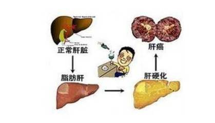 咳嗽跟肝有关系吗