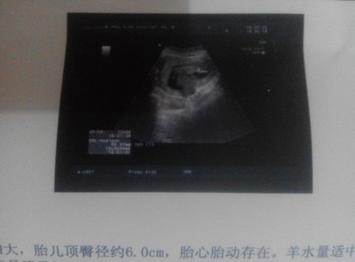 胎儿14周会有胎动吗