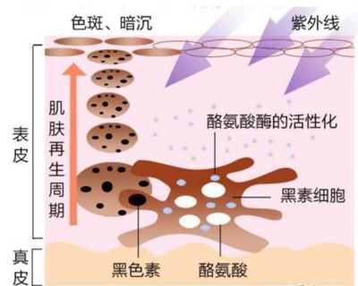 皮肤美白的原理