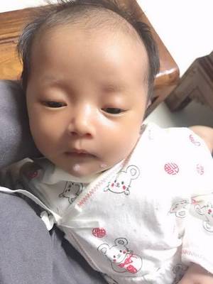 宝宝一个脸大一个脸小怎么纠正
