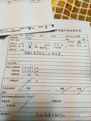 几个月没怀孕正常吗