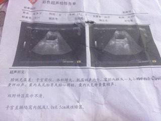 多少天会怀孕