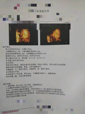 怀孕位置低