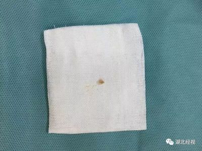 左边嘴巴长痘痘是什么原因