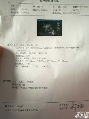 怀孕36周孩子一般几斤