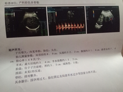 孕37周羊水应该是多少