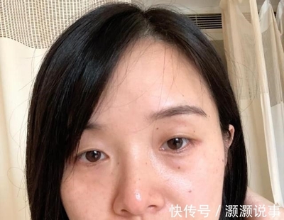廉价化妆品的危害