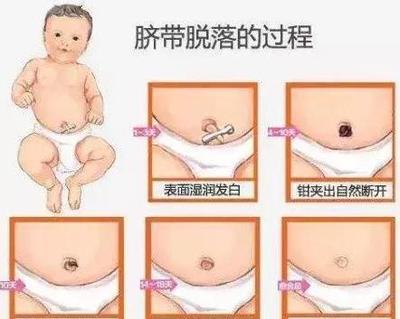 新生儿脐部护理流程