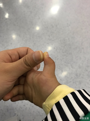 宝宝大拇指伸不直图片
