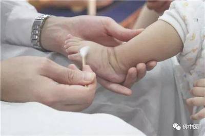 宝宝脚掌内翻