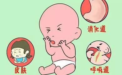 宝宝容易过敏的食物