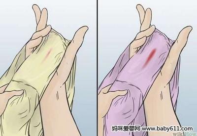 经血呈褐色是怎么回事