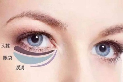 怎么治疗大眼袋