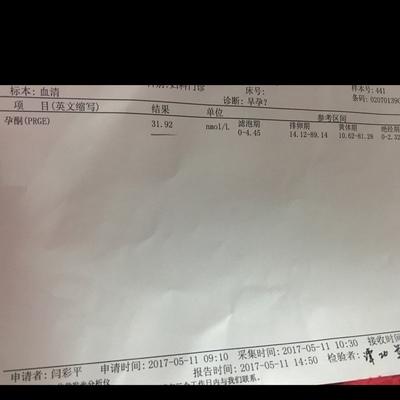 排卵期英文