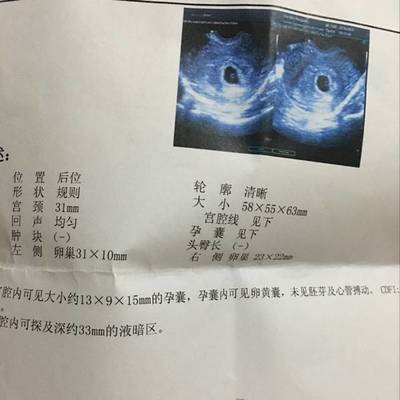 怀孕多久可以鉴定男女