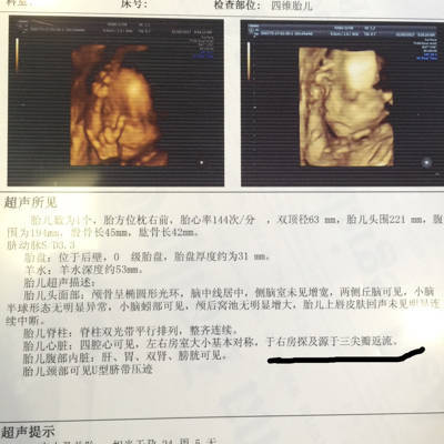 怀孕六个月胎儿有几斤
