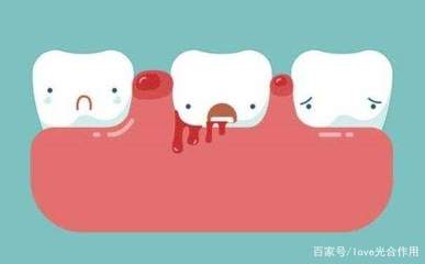 牙根出血是怎么回事