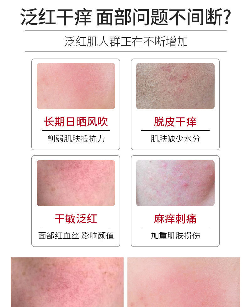 脸部角质层增厚