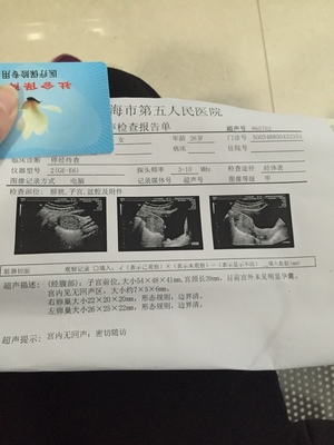 怀孕6周彩超图片