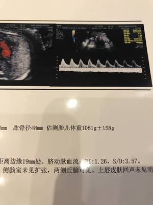 腹围和宫高计算胎儿体重