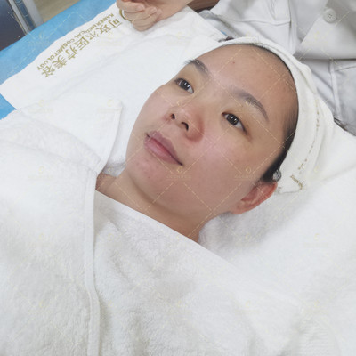 无针水光术后注意事项