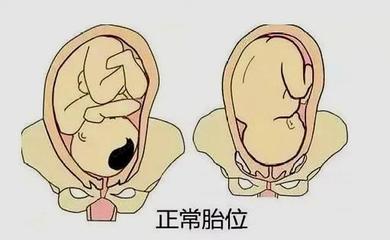 胎儿胎位什么时候固定