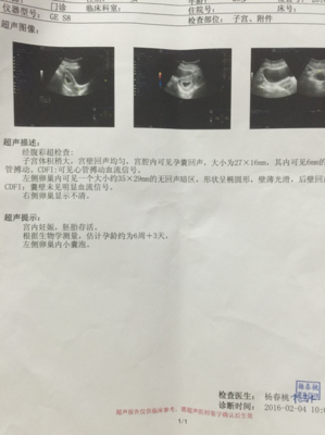 怀孕检查什么项目