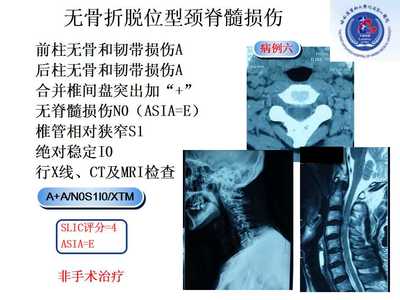 颈椎突出怎么治疗效果好