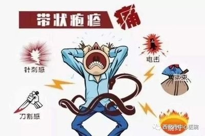 带状疱疹后遗神经痛怎么治疗