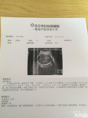 胎儿偏瘦