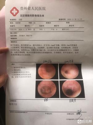 宫腔镜检查疼吗多少钱