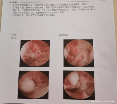 没有成熟的卵泡会怀孕吗