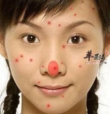 脸上总是有小痘痘