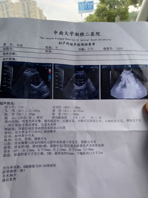 孕37周羊水应该是多少