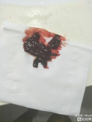 例假有血块是怎么回事