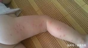手心很烫是怎么回事