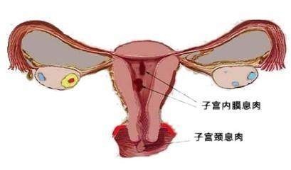 宫颈炎影响怀孕吗