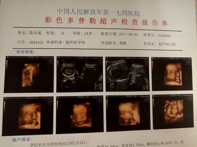 怀孕6个月胎儿图片